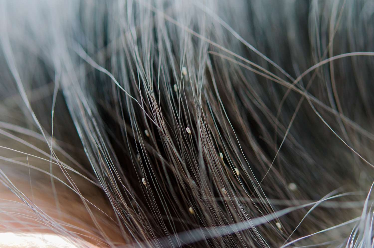 Does hair color kill head lice? 1 Surprising Answer